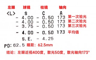 为什么验光单右眼在前，为什么验光单右眼在前面看不清